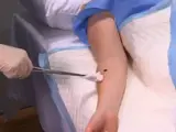 Nurse swabs a patient prior to a minor surgery